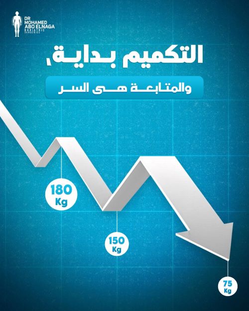 معدل نزول الوزن بعد التكميم